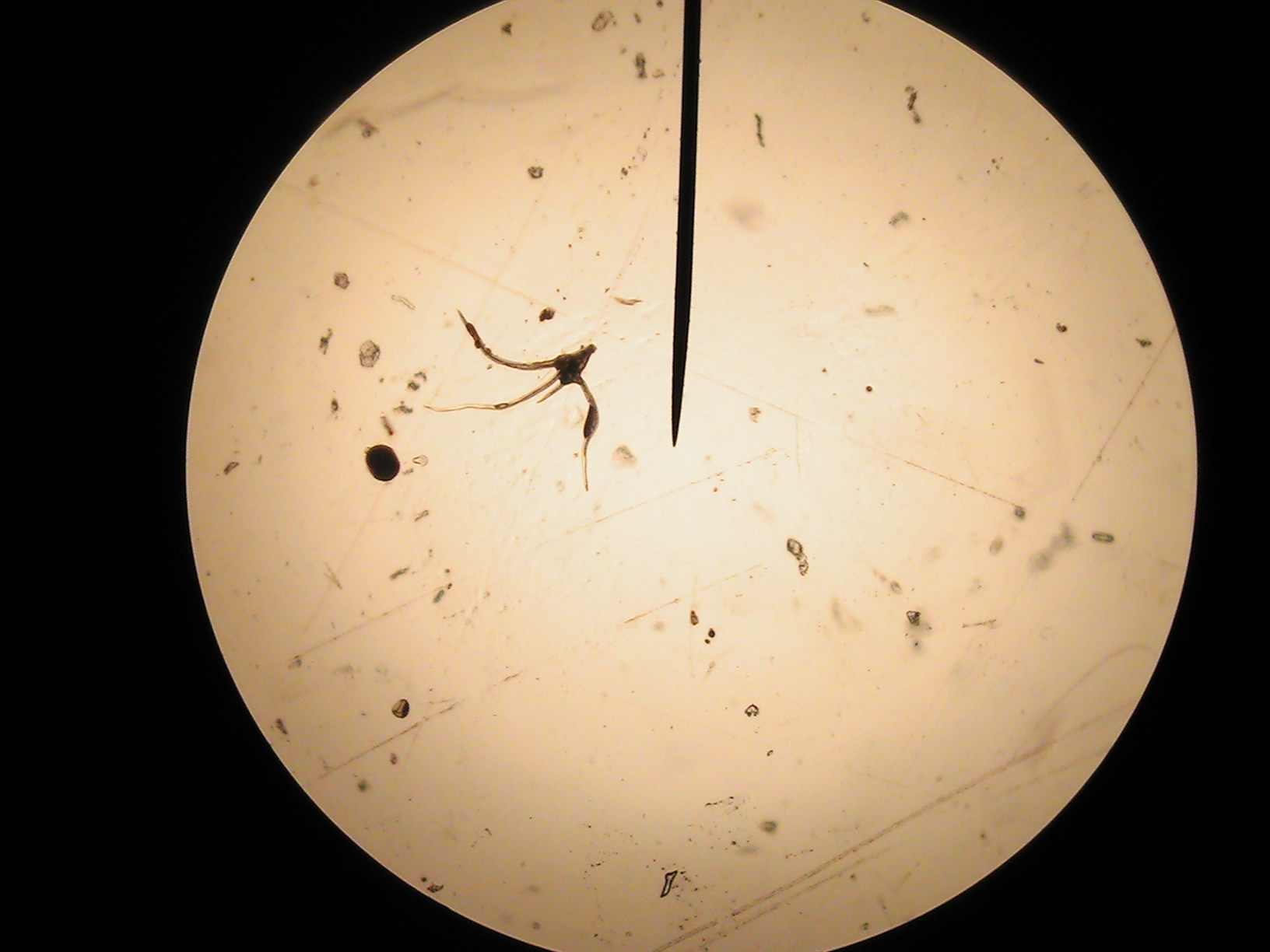 aerosol spray sample 1000x under microscope